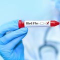 Bird Flu test