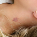 A blonde lady with a hickey on her neck